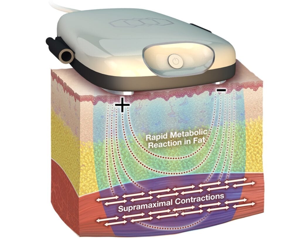 tone diagram