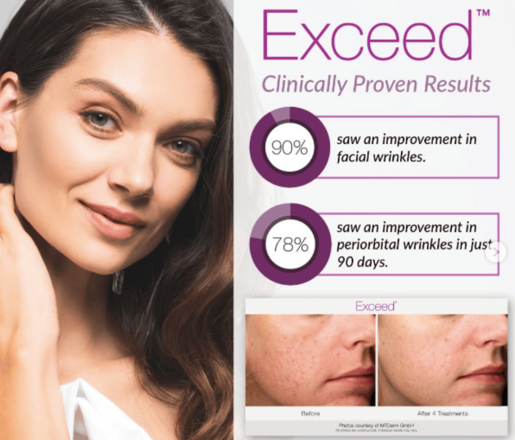exceed-clinically-proven-results