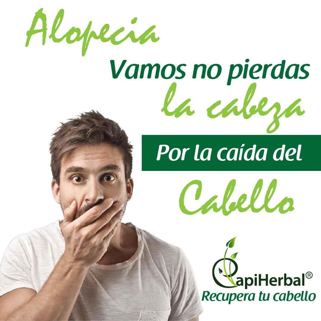 No pierdas la cabeza por la alopecia