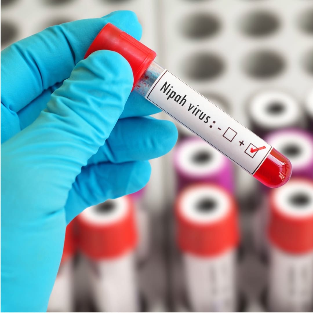 Nipah Virus: The Deadly Virus You’ve (Probably) Never Heard Of — But Should Know About
