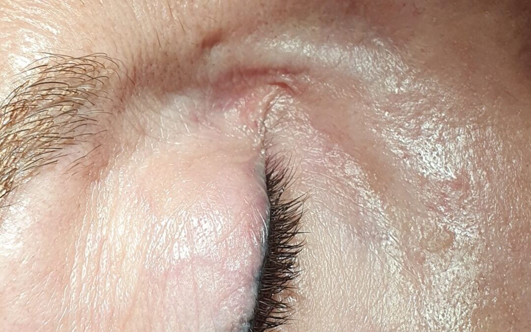 Corrección micropigmentación ojos