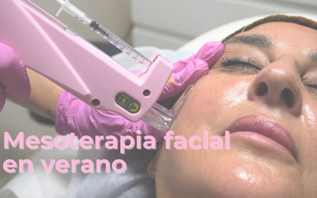 Mesoterapia facial en verano: beneficios, cuidados y resultados