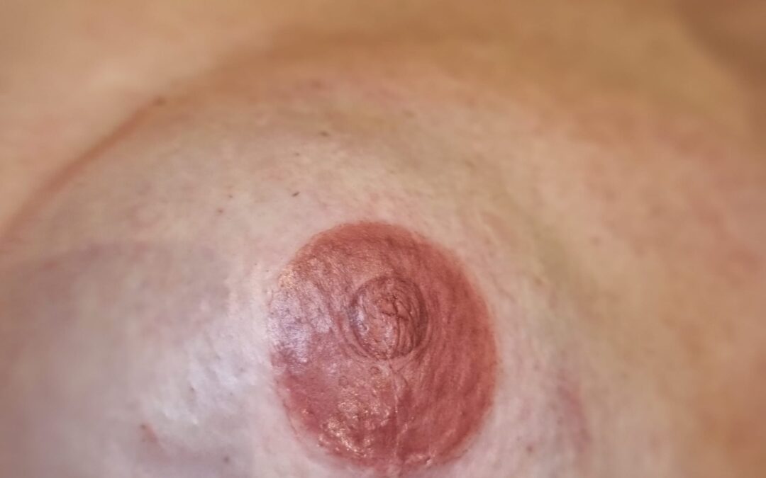 Micropigmentación 3D de areola: naturalidad tras la reconstrucción