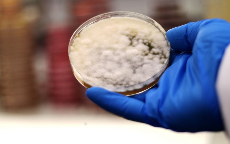 Fungi vs. Bacteria: How To Tell Them Apart At Home