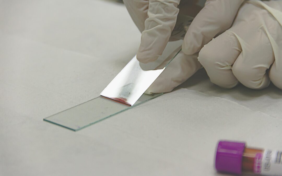 A Fully Automated High-Throughput Liquid Chromatography Tandem Mass Spectrometry Method for Measuring Creatinine in Urine