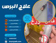 علاج البرص