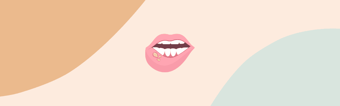 Abcès dentaire