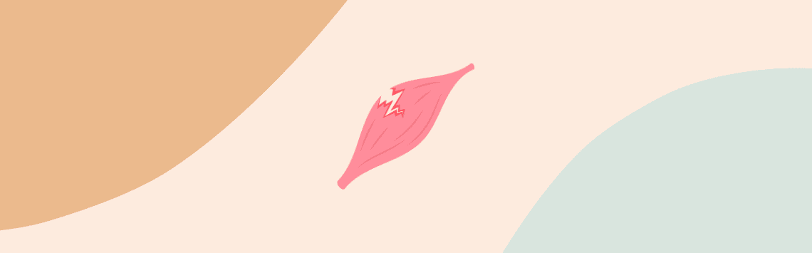 déchirure musculaire