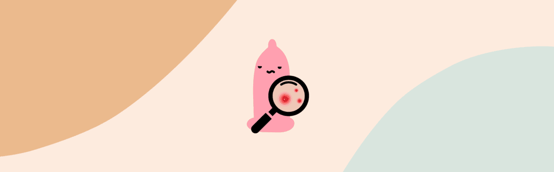 bouton gland