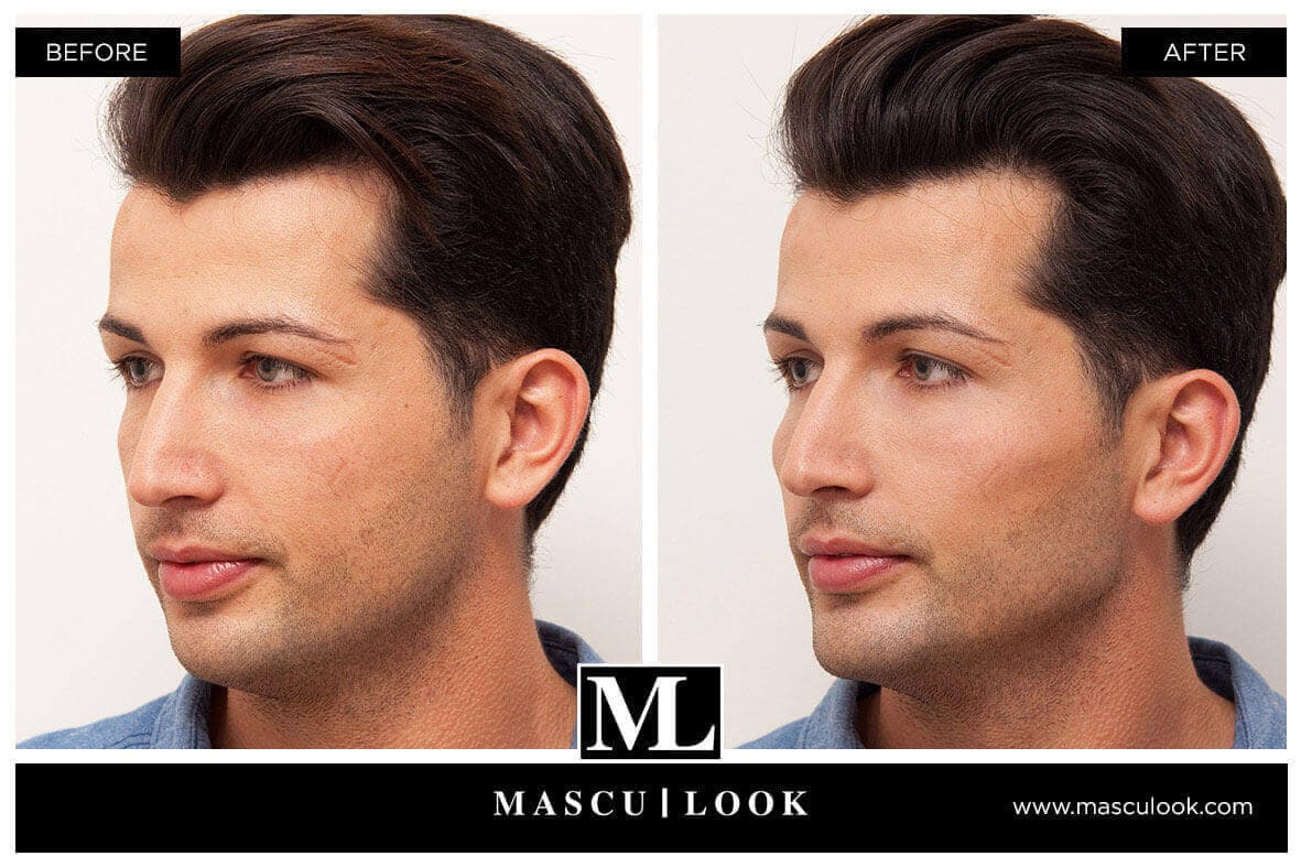 Mascu-Look en Clínica Fontana Valencia