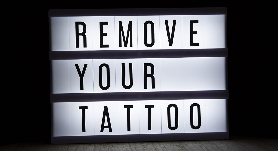 Top 10 Frequently Asked Questions About Tattoo Removal