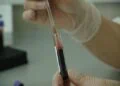 VIH Sida - crainte d'un relance de l' épidémie