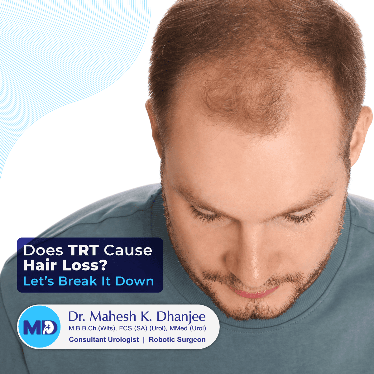 Does TRT Cause Hair Loss