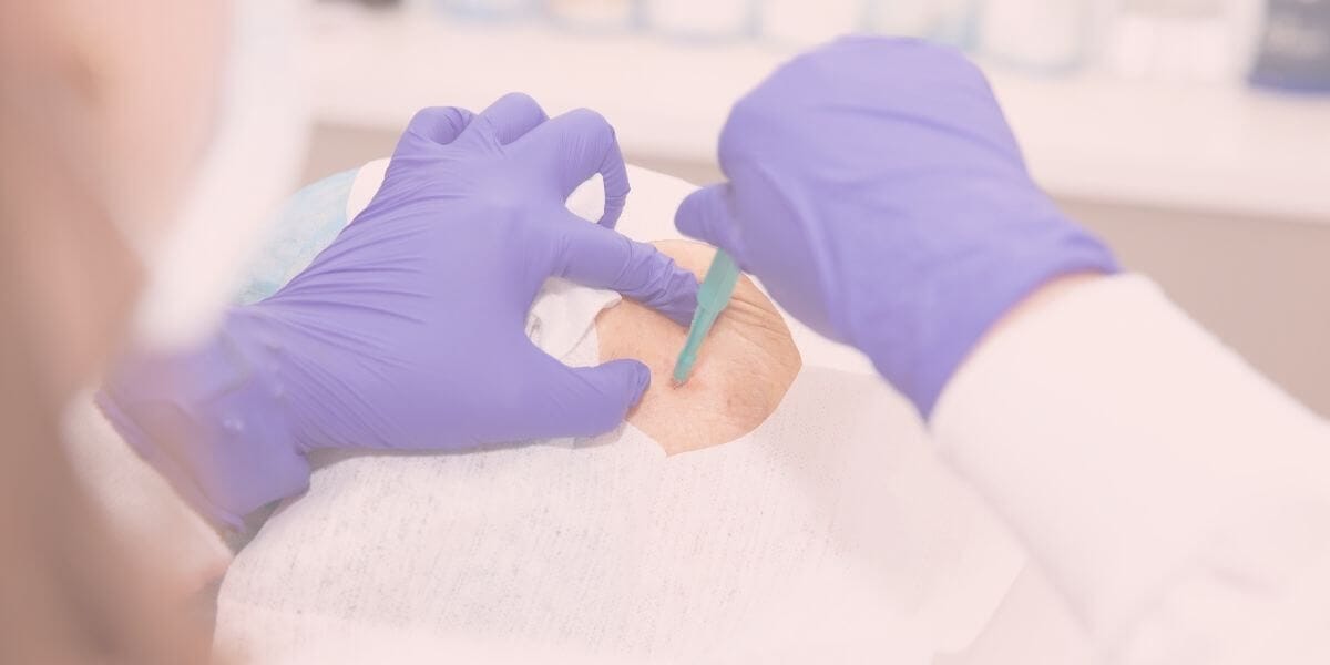 What to Expect During a Lung Biopsy (The Day Everything Changed)
