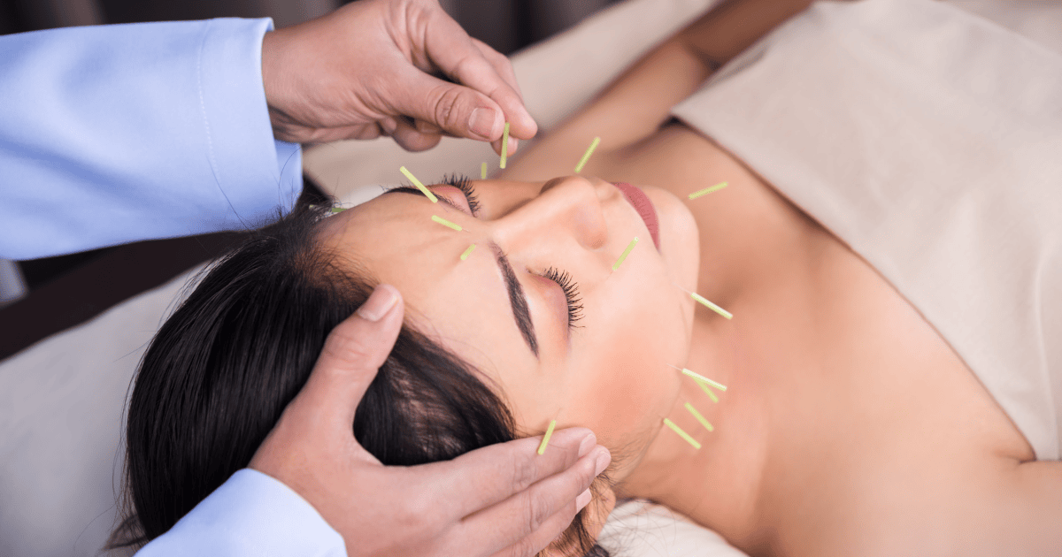 the healing touch of acupuncture