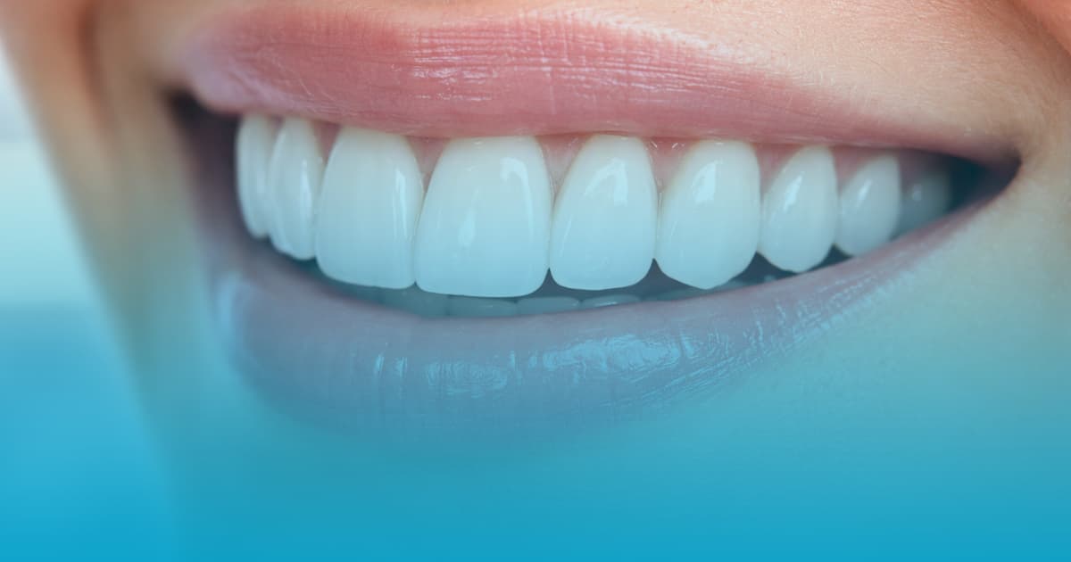 fatete dentare avantaje