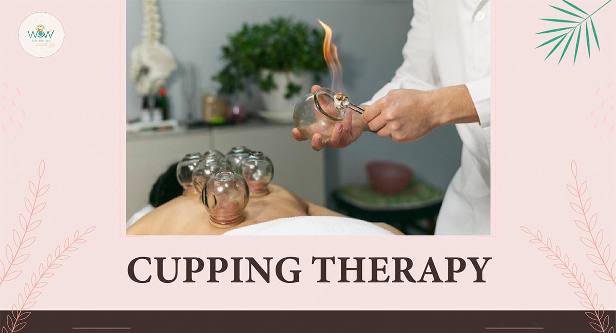 Cupping Therapy