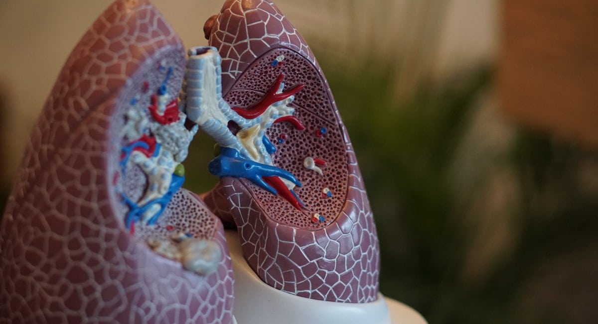 What Are The Early Signs And Symptoms Of Lung Cancer?