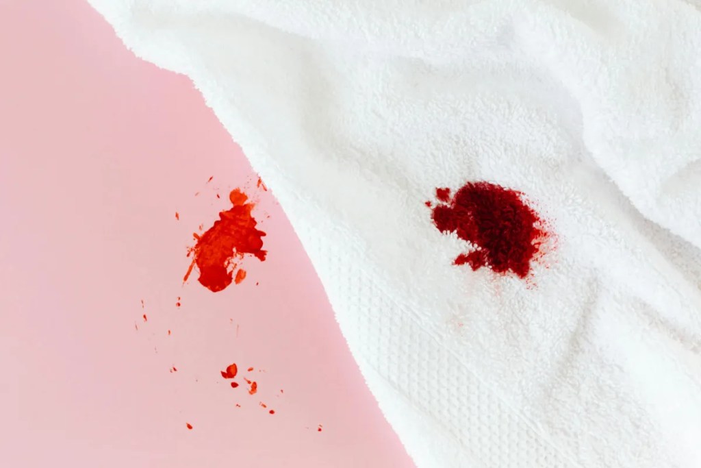 when-not-to-use-warm-compress-pilonidal-cyst Stop using a warm compress if a pilonidal cyst is draining blood or pus