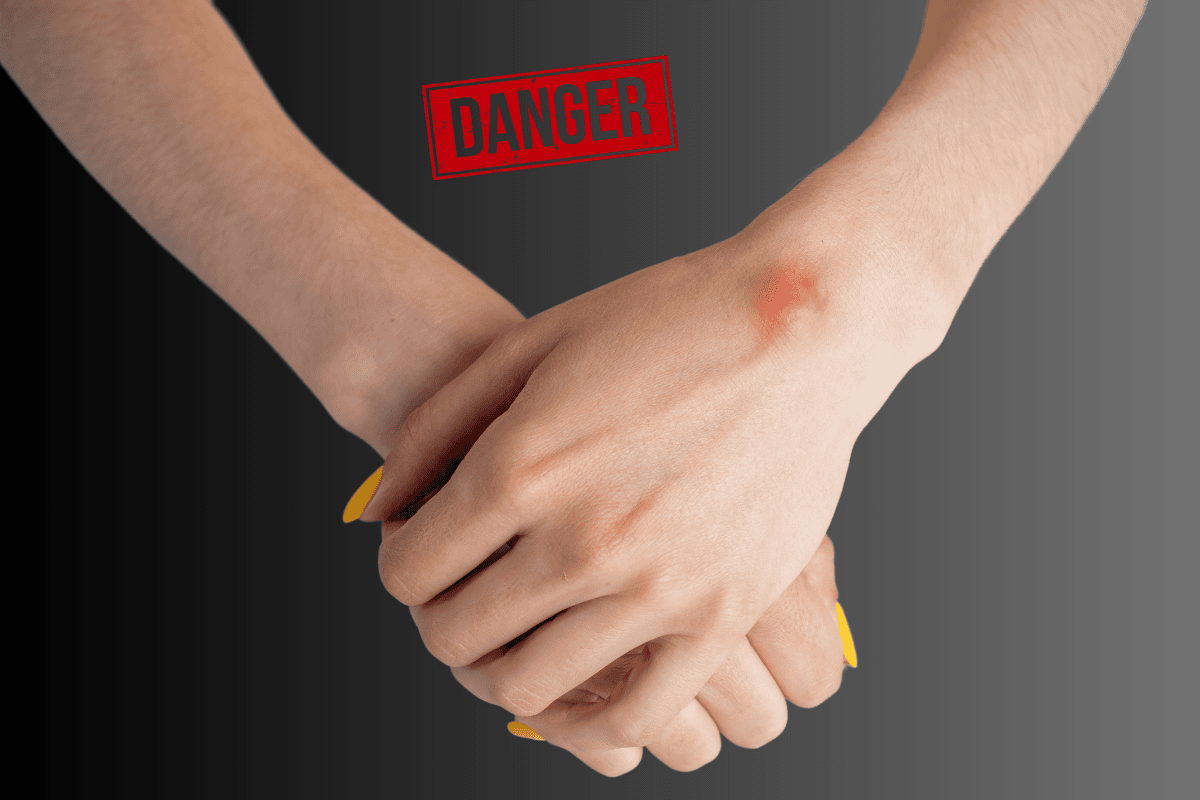 Is a ganglion cyst dangerous?