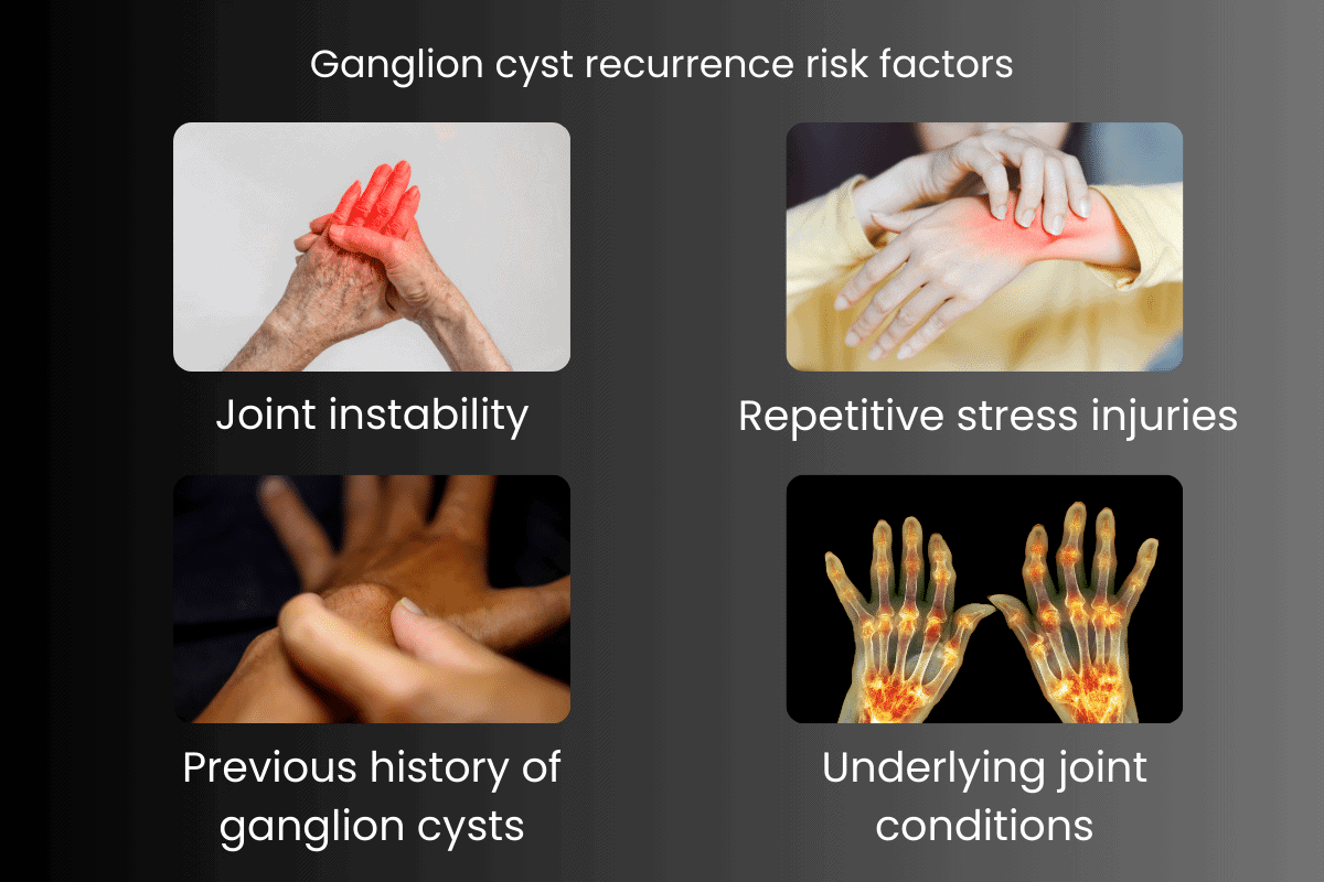 Ganglion cyst recurrence risk factors