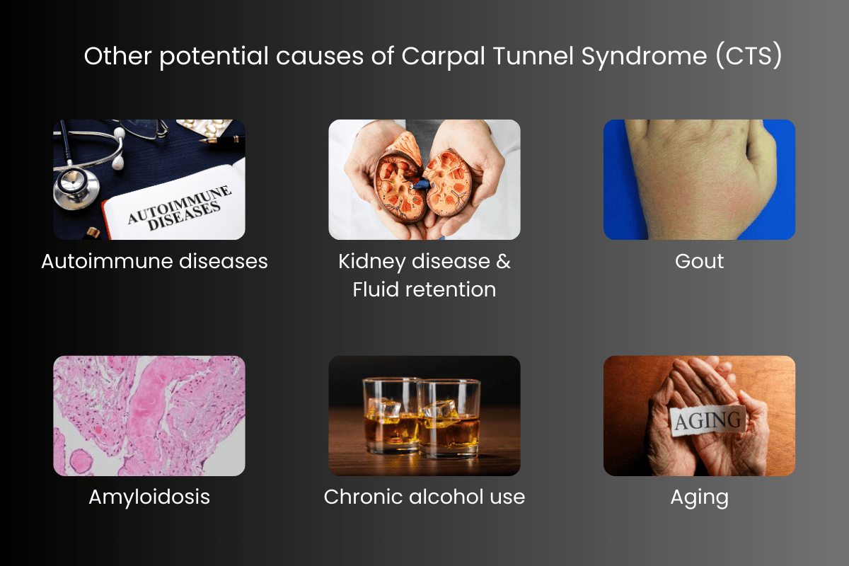 Other potential causes of carpal tunnel syndrome