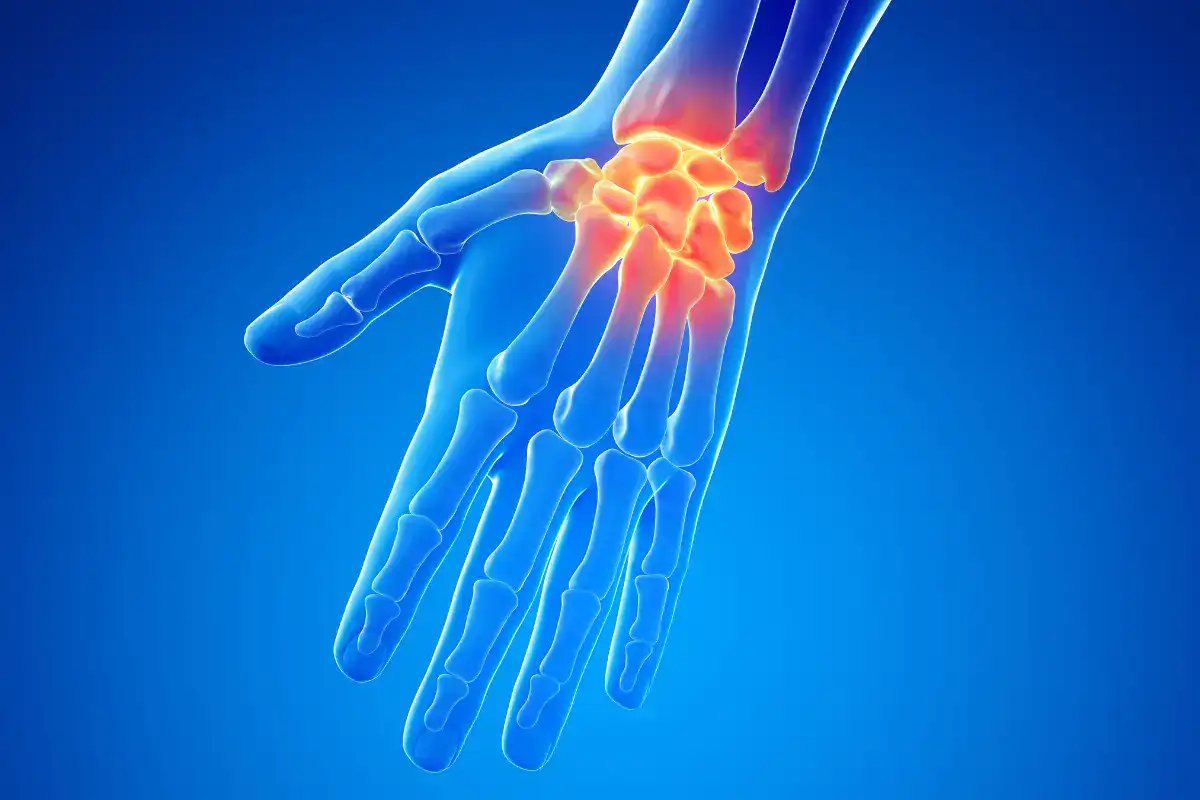 Wrist pain Symptoms, Causes & Treatment