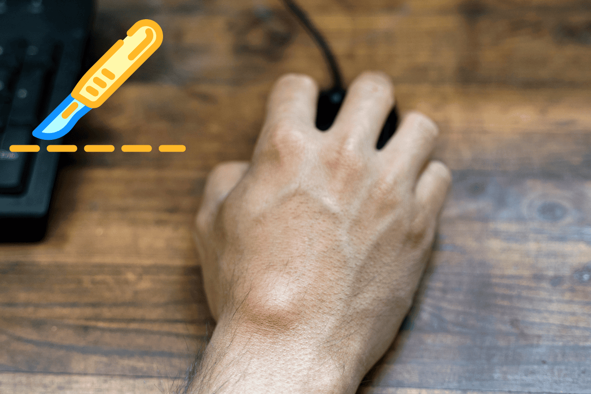 Ganglion cyst removal surgery_ Procedure & Recovery timeline