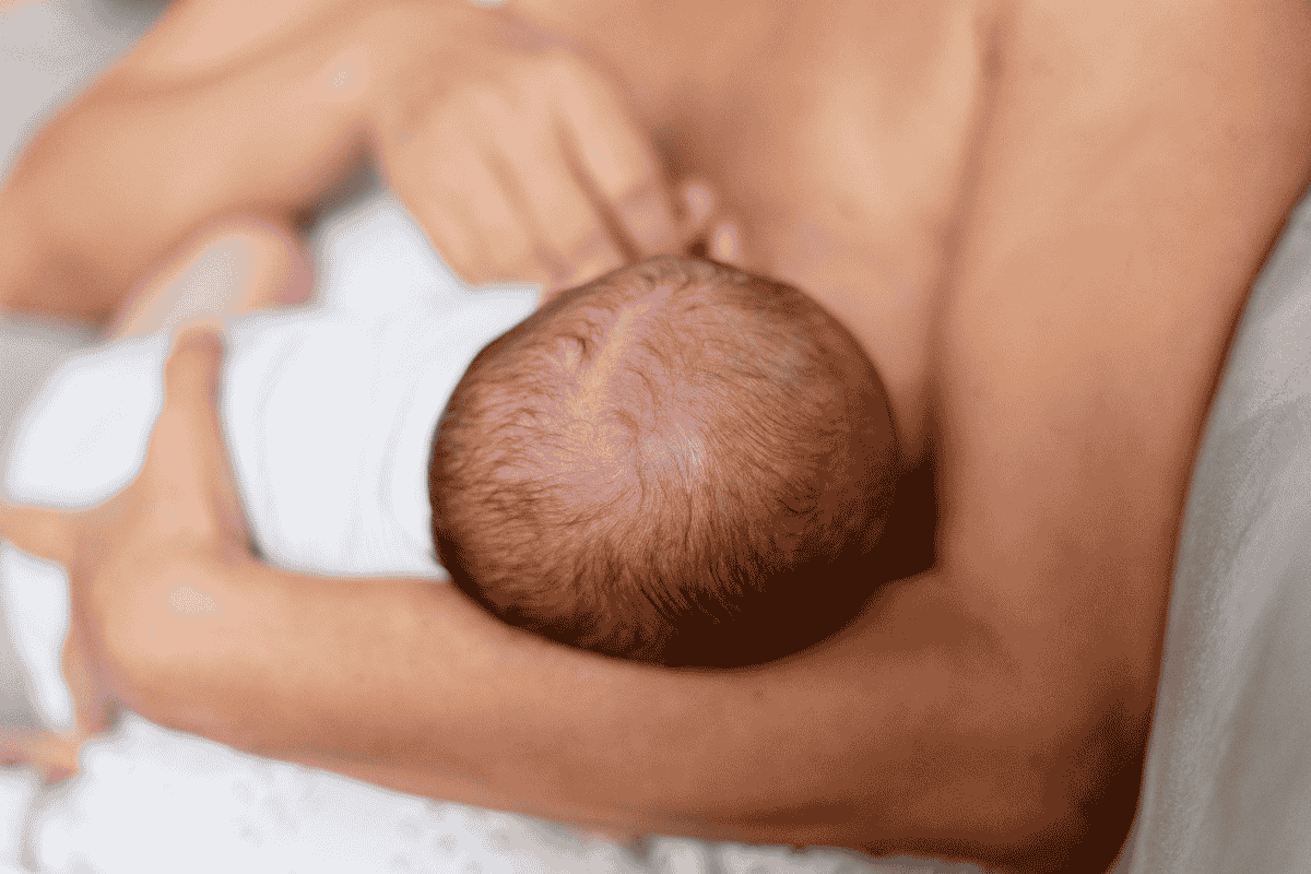 Fisioterapia pediátrica tras frenectomía para mejorar la lactancia materna en bebés