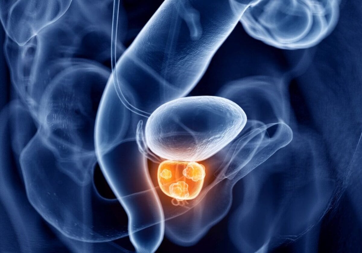 https://urologistdubai.ae/wp-content/uploads/2024/01/pros-1280x895.jpg