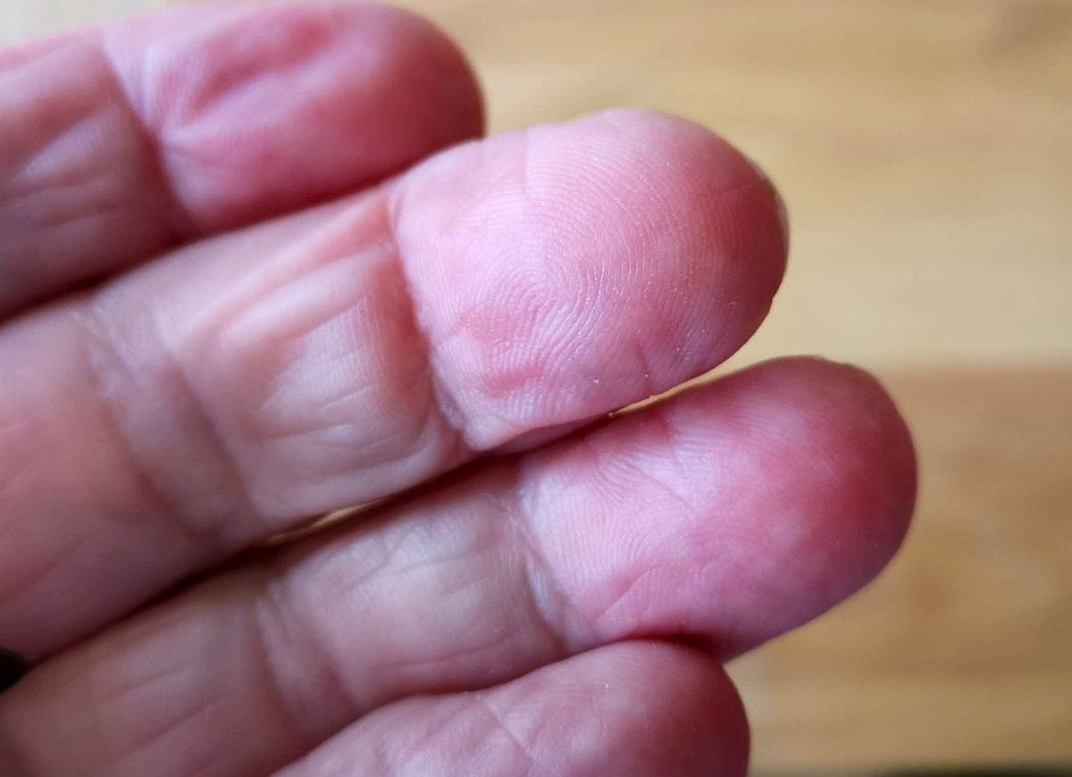 Die einzigartige Anordnung der Papillaren auf den Fingerkuppen (Foto: Digisaurier)