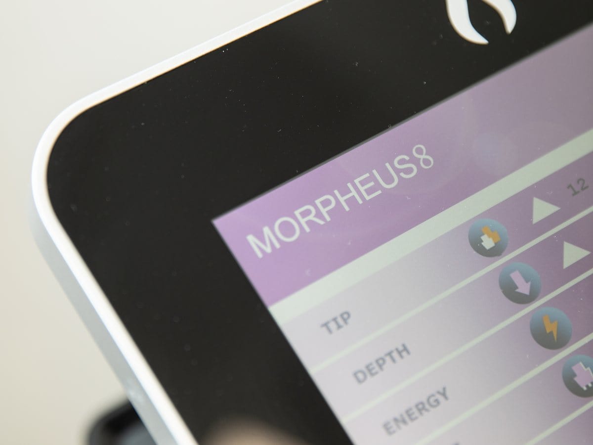 Pantalla del equipo Morpheus8 en Clínica Fontana, Valencia