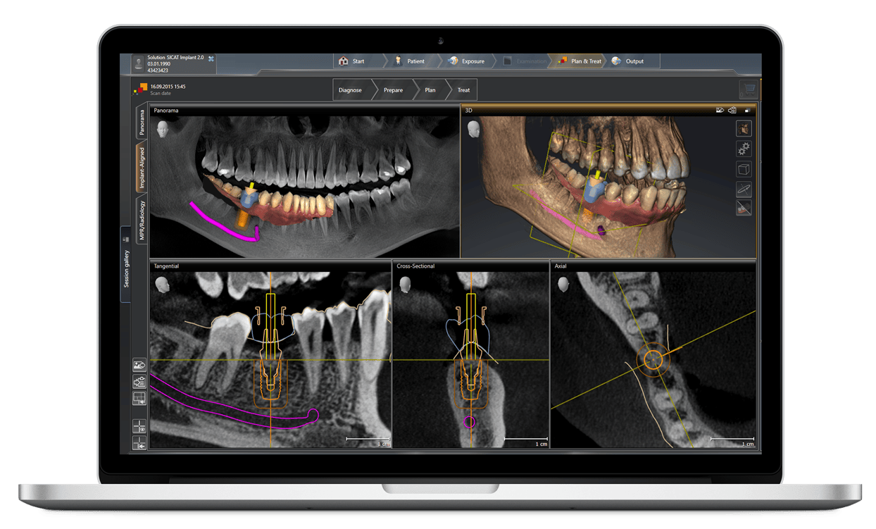 3D-Röntgen, DVT - digitale Volumentomographie
