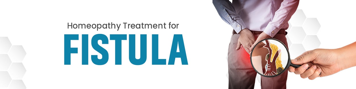 A comprehensive guide to the different types of fistula and symptoms, including medical classifications, causes, and effective prevention strategies.