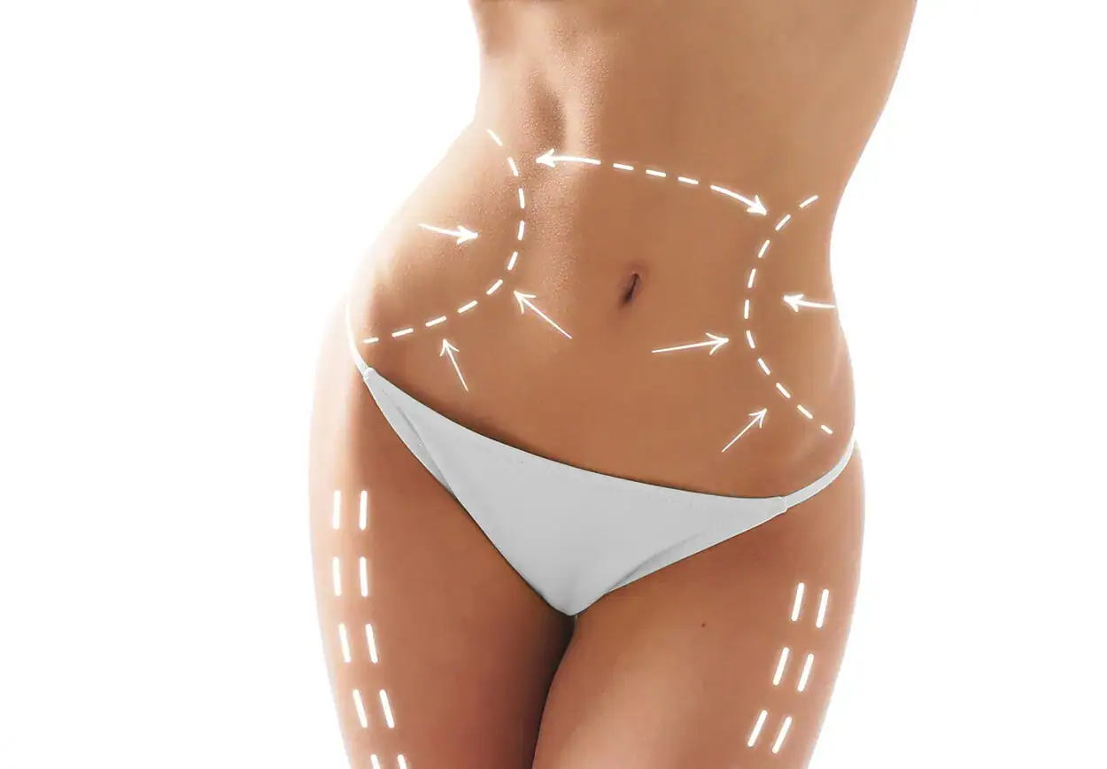 body sculpting