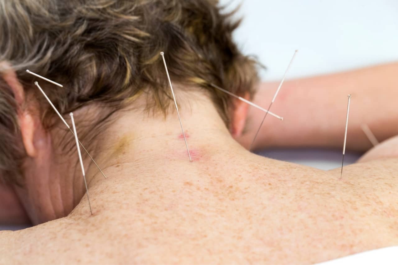 acupuntura medica sao paulo4