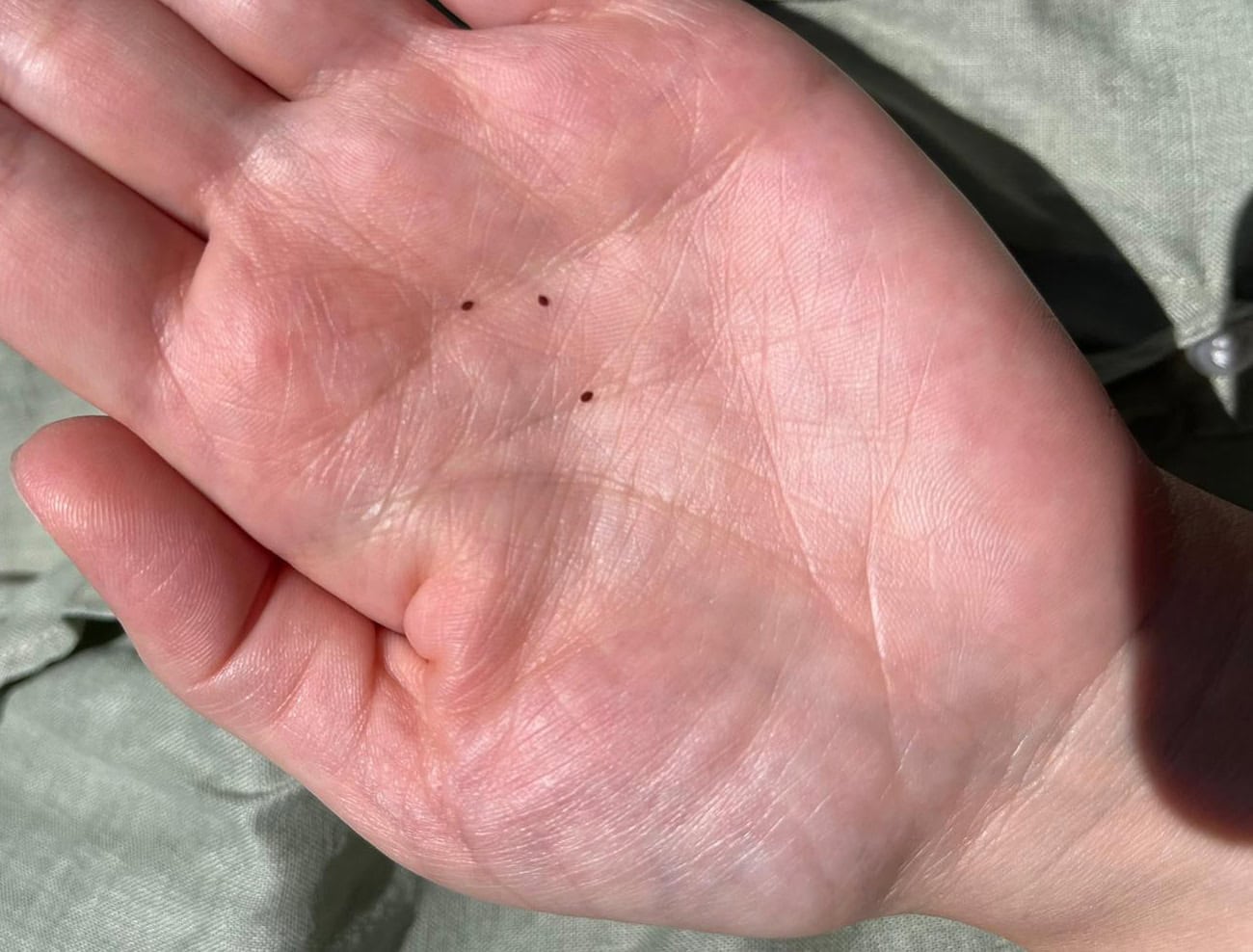 Are Bird Mites Dangerous to Humans