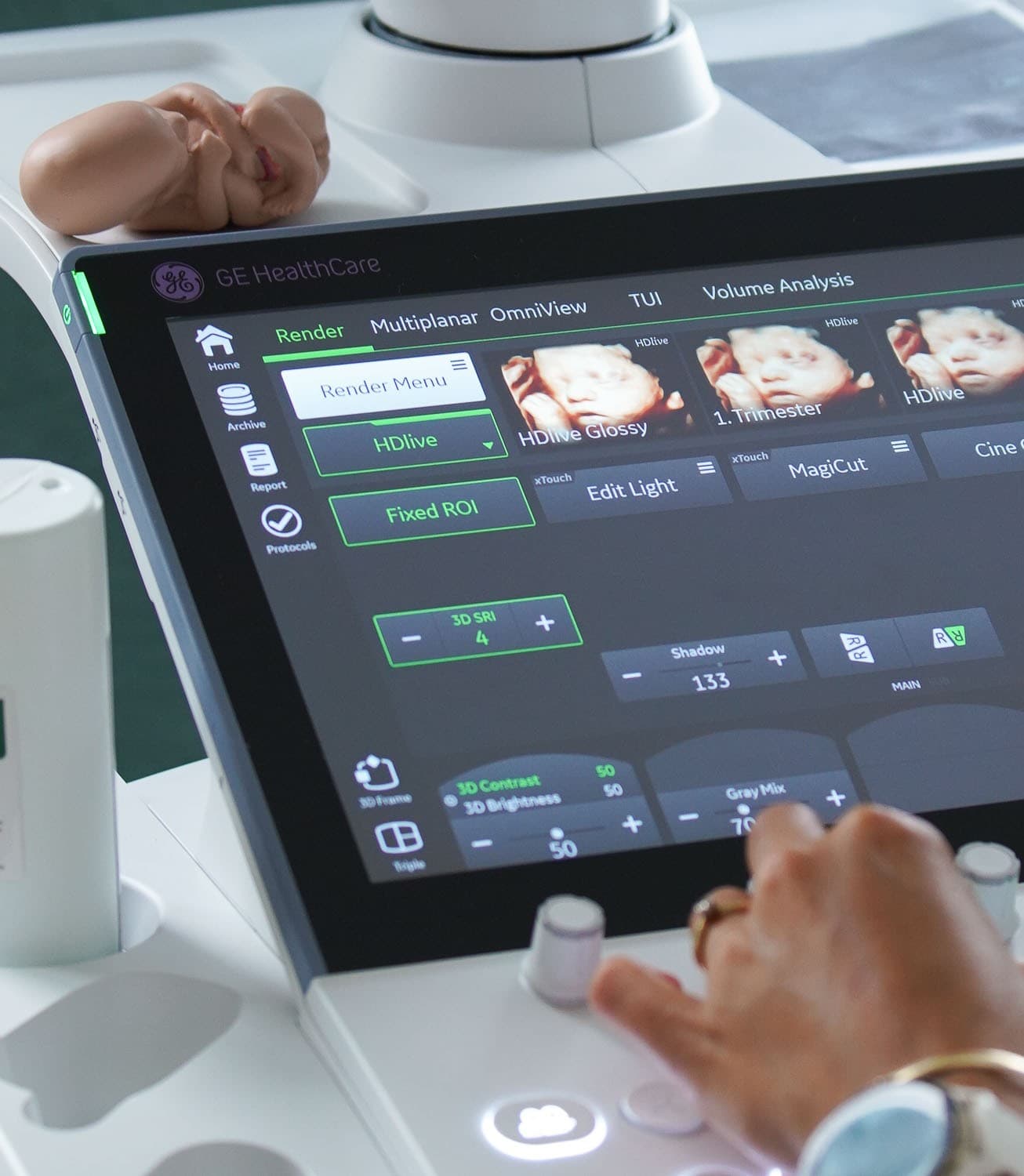 Echografie bij Echo Care