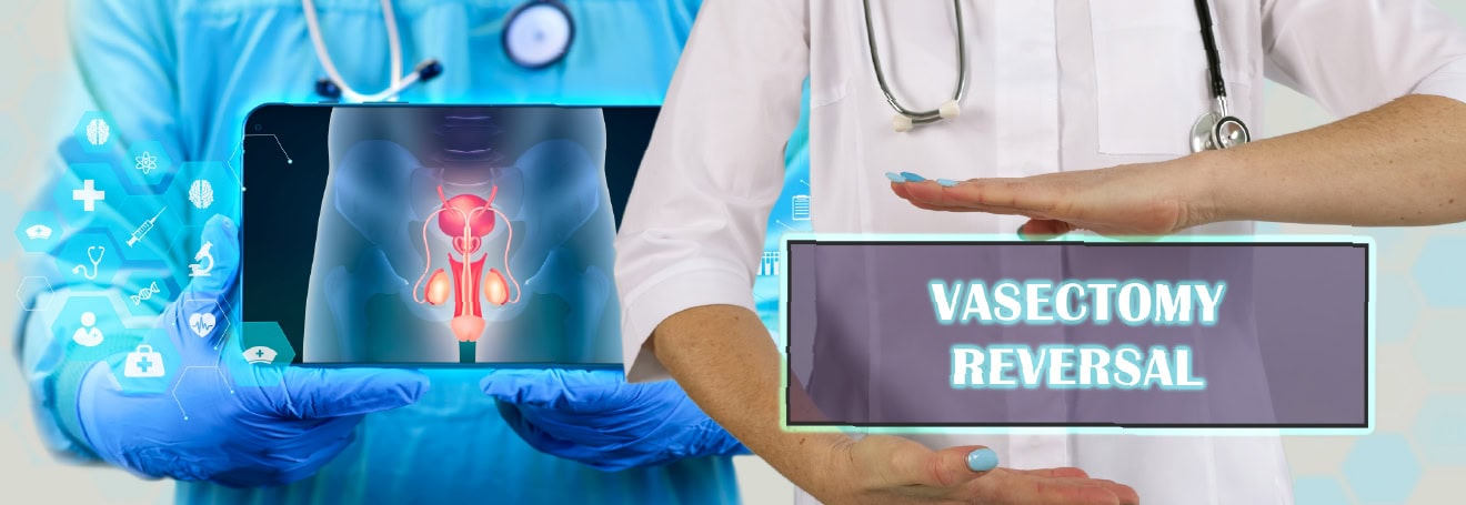 vasectomy reversal
