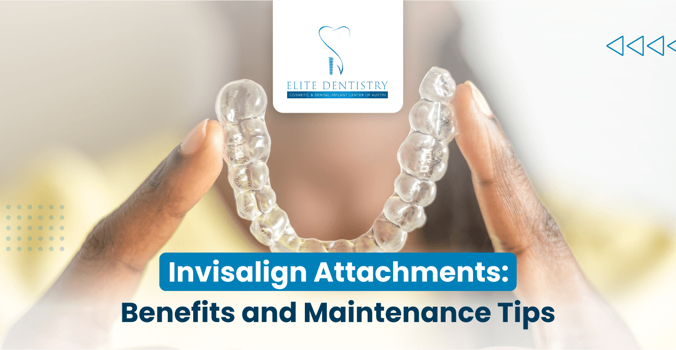 Blog cover image: Invisalign Attachments