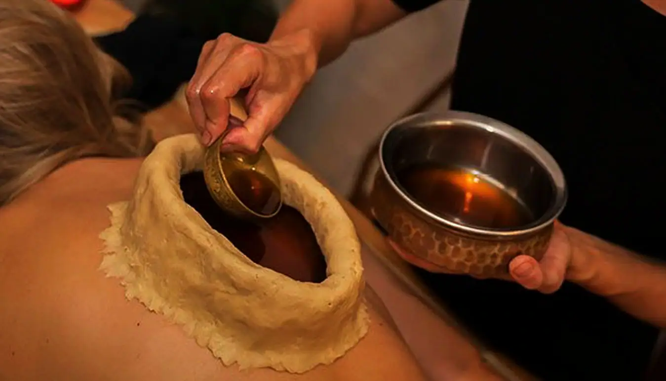 Vasti -Kati Basti Ayurvedic Treatment A close up shot of an Ayurvedic treatment where a high dough ring is placed on a person's back. A practitioner is pouring warm, dark therapeutic oil from a small golden bowl into the center of the ring.