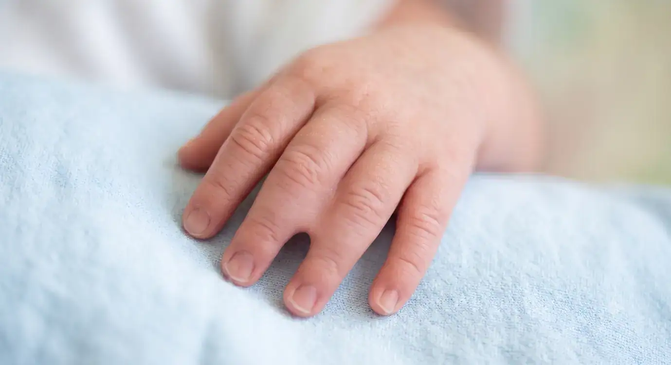 Why Does My Baby Have Webbed Fingers