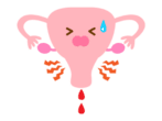 生理痛が起こっているときの子宮周辺