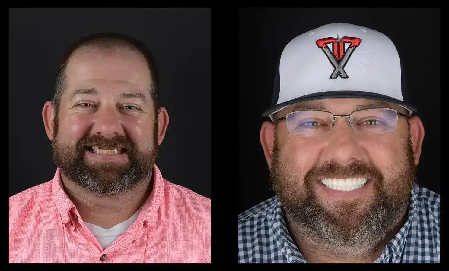 dental implants austin