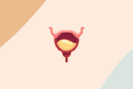 cystite femme