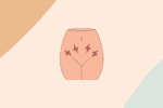 traitement infection urinaire sans ordonnance
