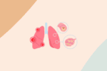 bronchite asthmatiforme