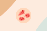 eczema penis
