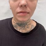 lobe lobepiercing piercingstudio ear earpiercing earpiercings piercingaddict piercingjewelry piercingshop piercinggirl piercer instapiercing piercedgirl lovepiercings piercingspecial pierced piercedgirl piercingday budapest 2