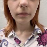 lobe lobepiercing piercingstudio ear earpiercing earpiercings piercingaddict piercingjewelry piercingshop piercinggirl piercer instapiercing piercedgirl lovepiercings piercingspecial pierced piercedgirl piercingday budapest septum 5